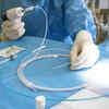 Procedure to treat type 2 diabetes helps keep off weight after patients stop GLP-1 drugs