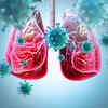 Nutritional support to 2.8 million TB patients could avert 120,000 deaths yearly in India: Study