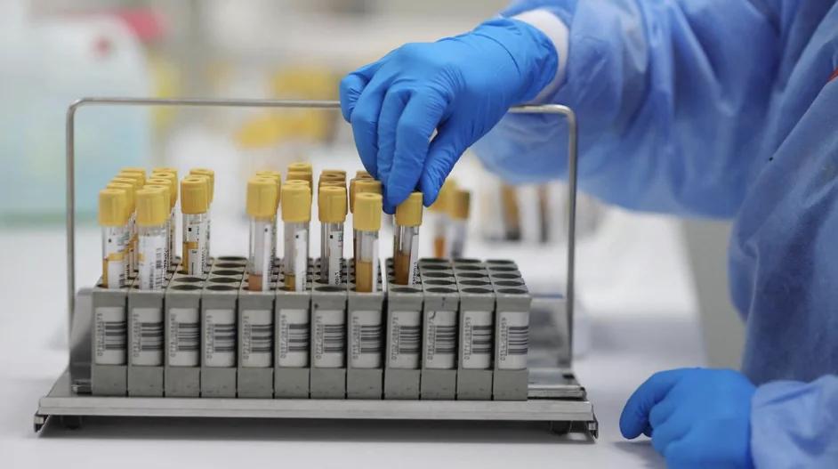 Demand for Advanced Screening Systems in Kerala Blood Banks to Detect Infections